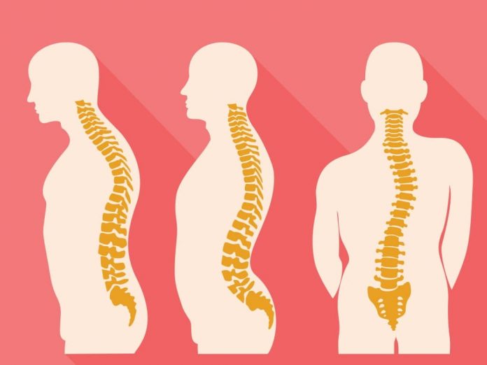 Spinal infections – a rare yet effective cause of spinal deformities