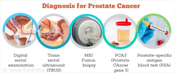 Prostate Cancer: Screening & Methods For Prevention - Northlines